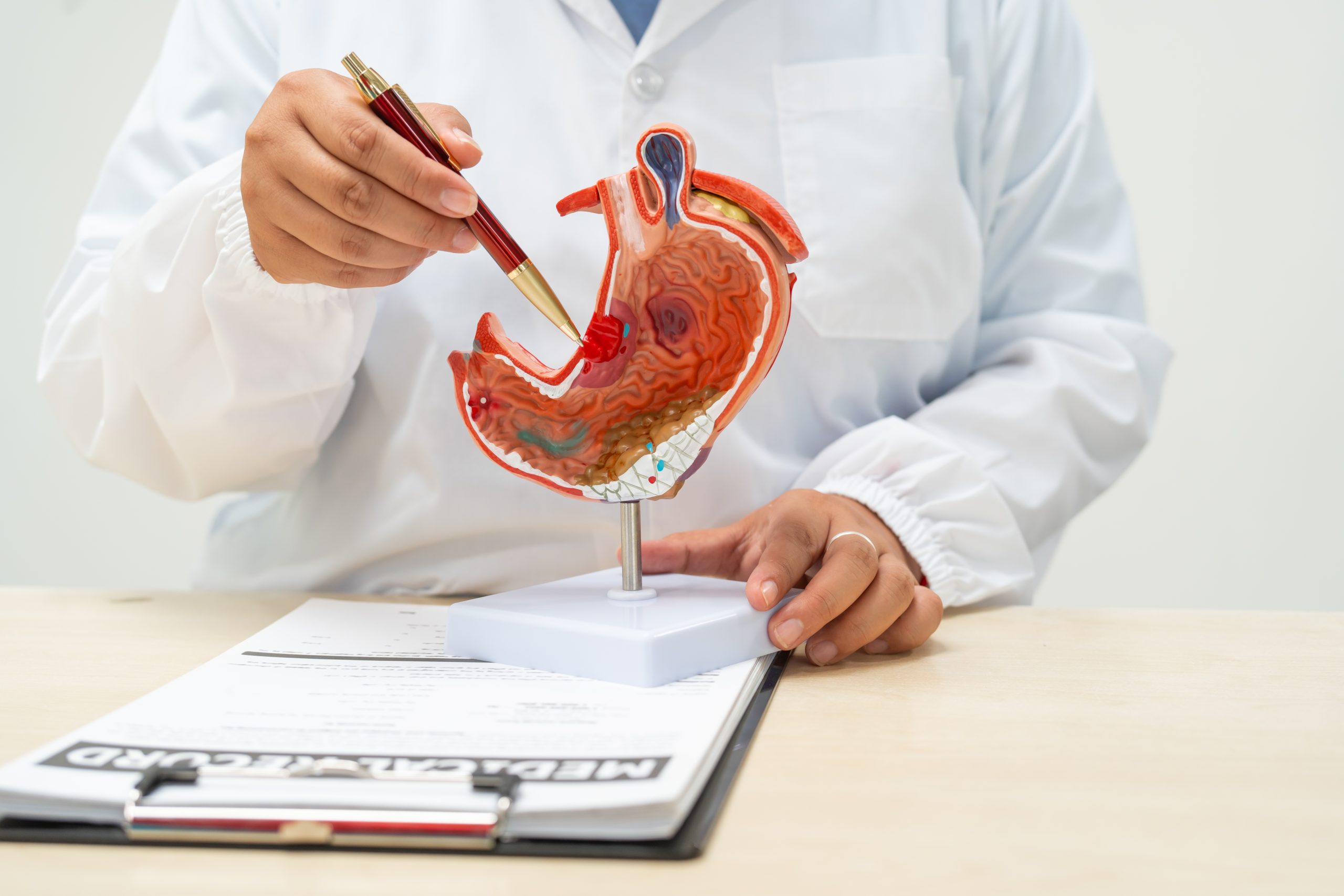 Roux-en-Y Gastrik Bypass (RYGB)