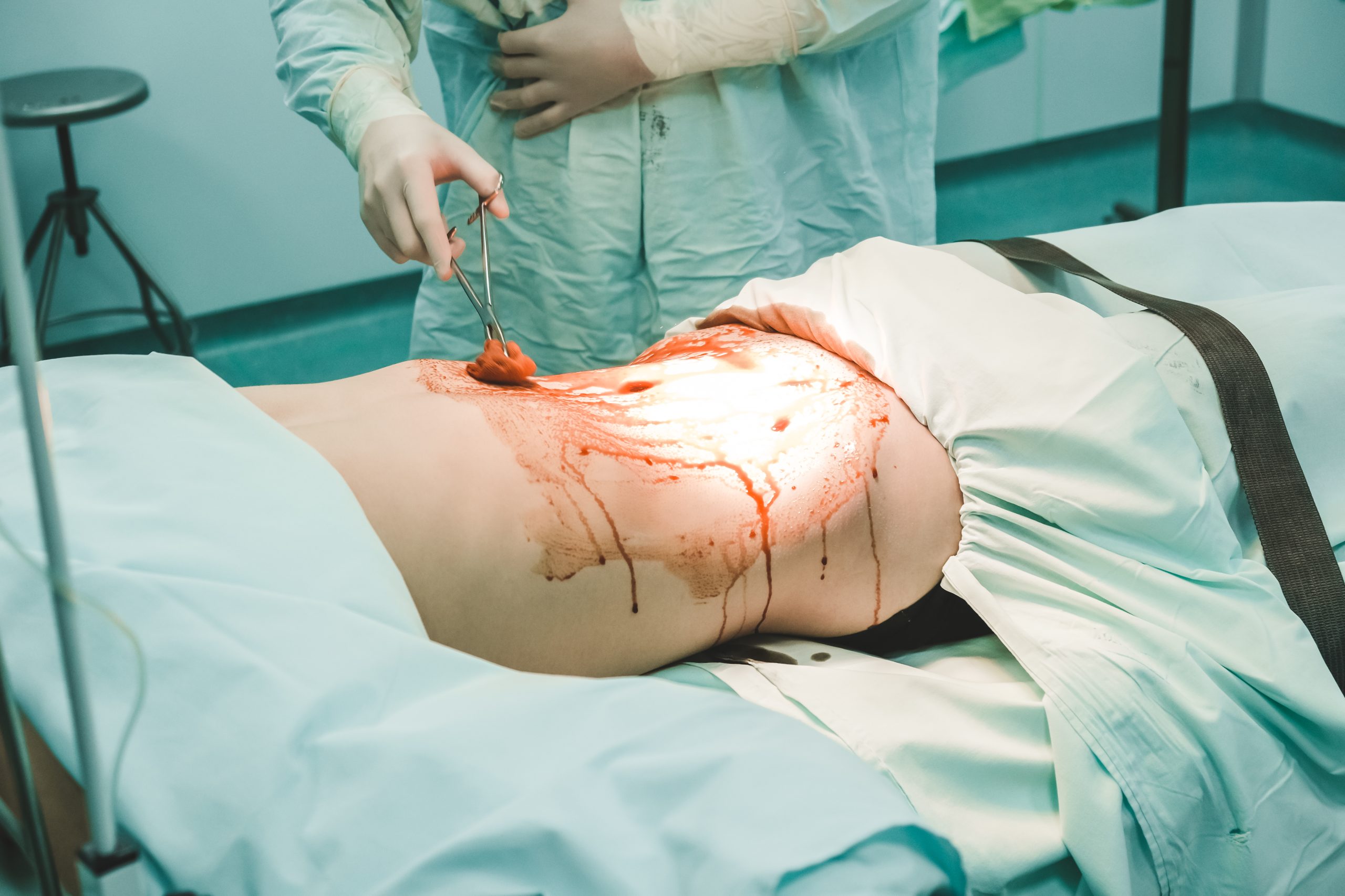 Preoperatif Hazırlık Adımları